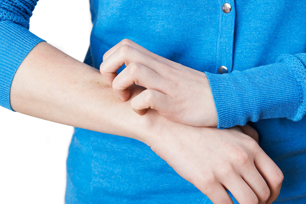 Psoriasis är en vanlig kronisk hudsjukdom som idag drabbar ungefär 300 000 svenskar. Drabbade kan behöva individuell behandling under långa perioder av livet.